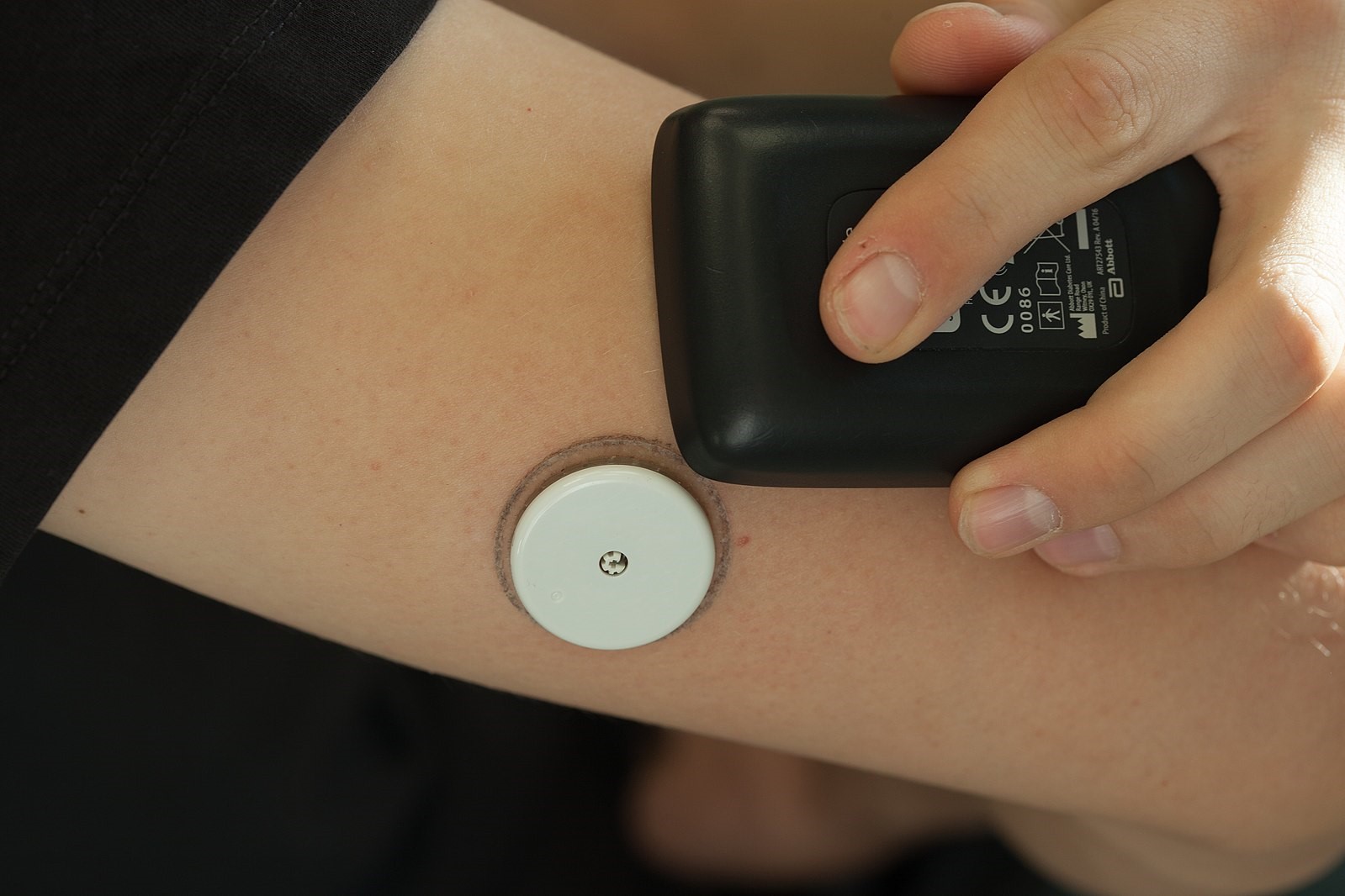 Blood glucose monitoring systems are on the rise but who really needs