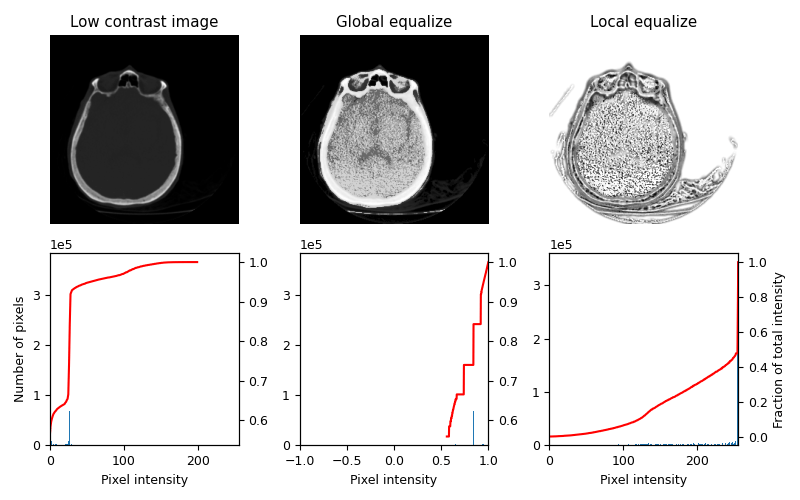 Local Histogram Equalization — skimage 0.21.0 documentation