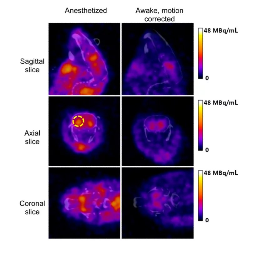 Preclinical Imaging of Conscious Unrestrained Animals