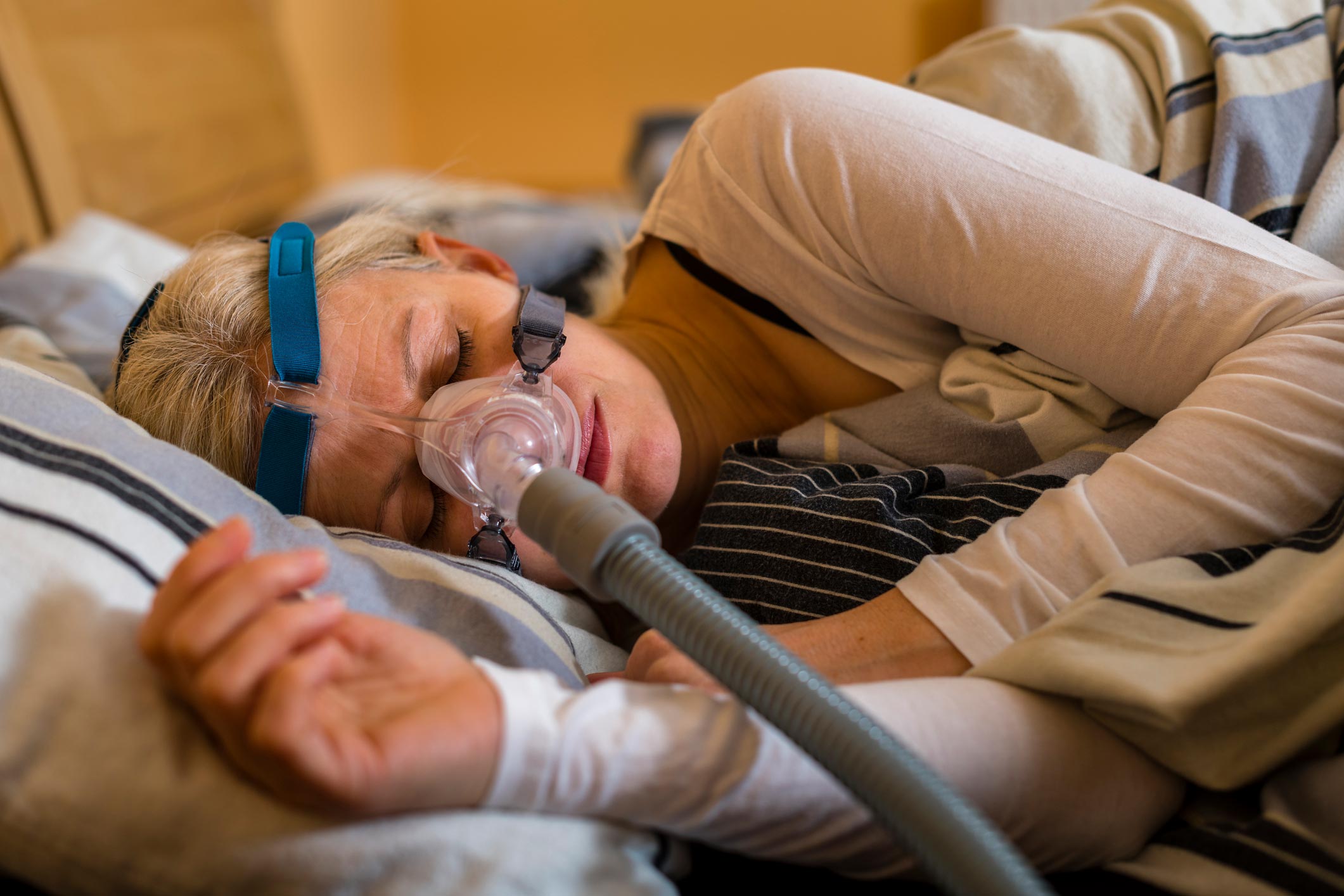 Obstructive Sleep Apnea Is Common in People With Cognitive Impairment
