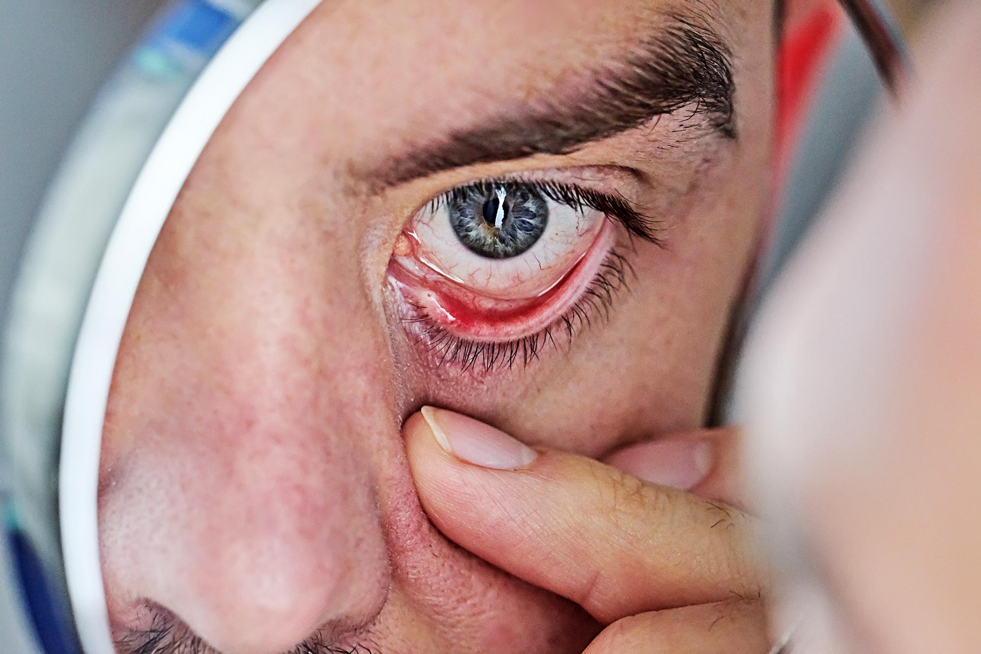 8 Ways to Beat Eyestrain and Revitalize Dry Eyes 8 Ways to Beat Eyestrain and Revitalize Dry Eyes