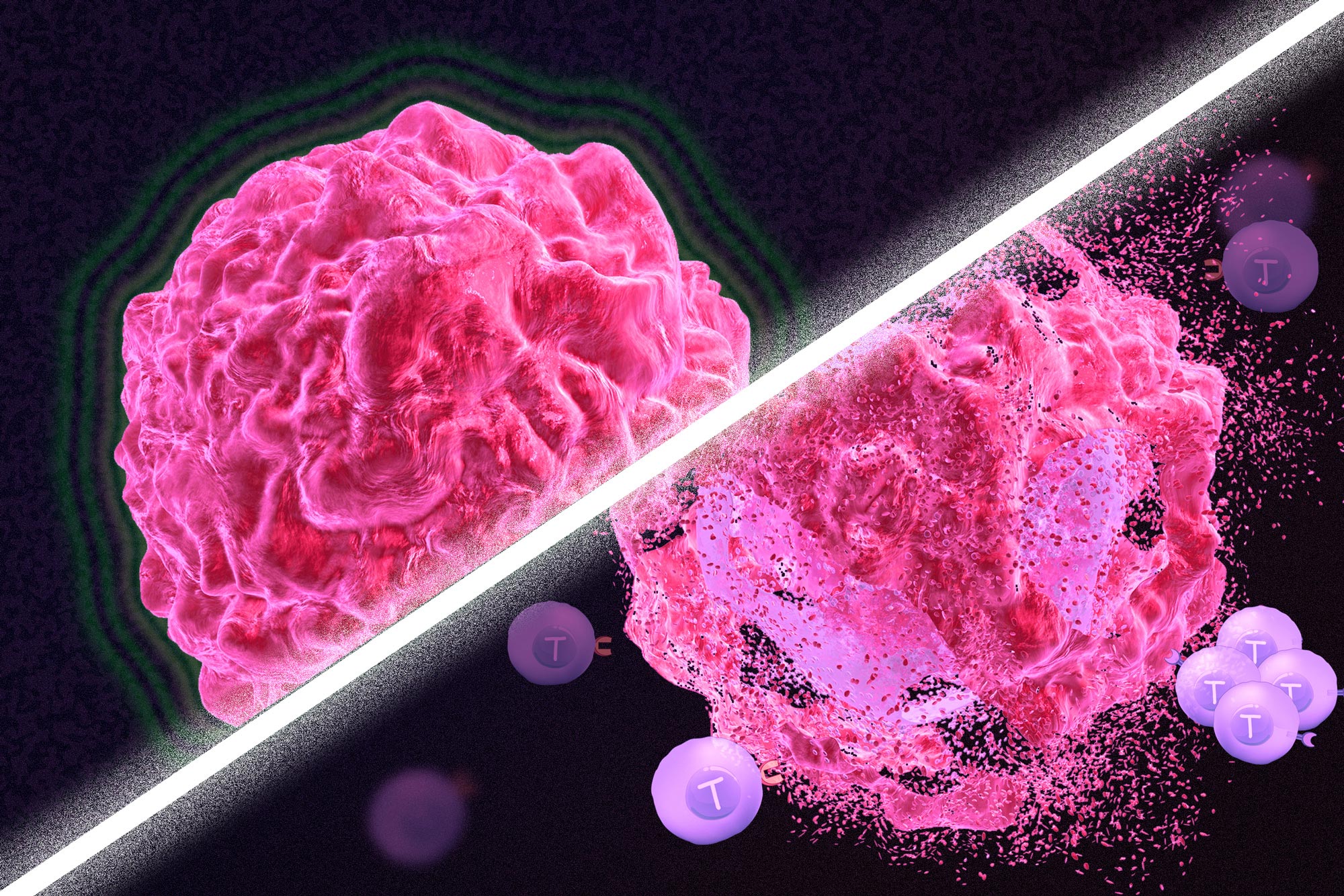 New MIT Cancer Treatment JumpStarts the Immune System