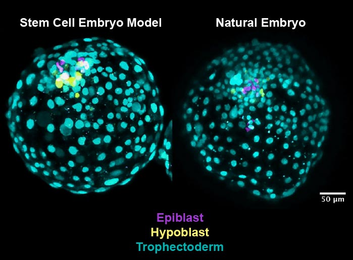 Early Human Embryo Structure Created With Stem Cells in Advance for