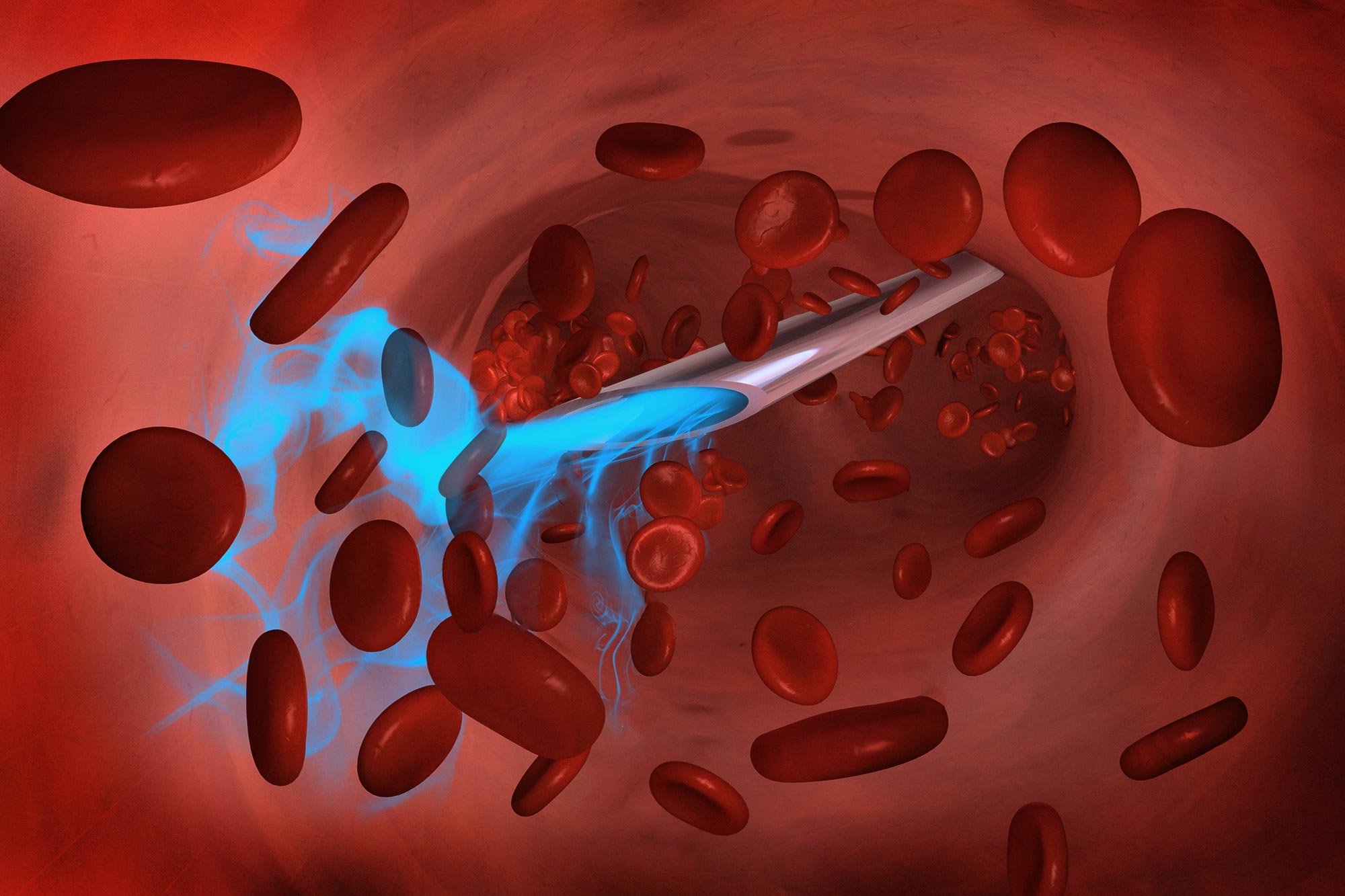 Researchers Develop a New Ultrafast Insulin for Management of Blood