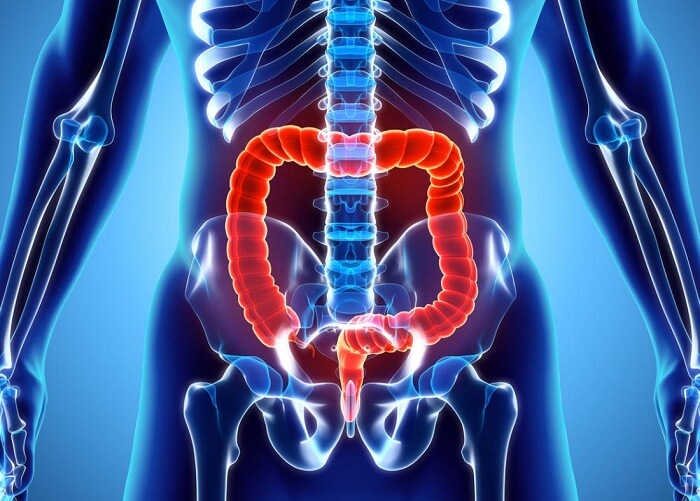 What is Ulcerative Colitis Causes, Symptoms and Treatment Scope Heal