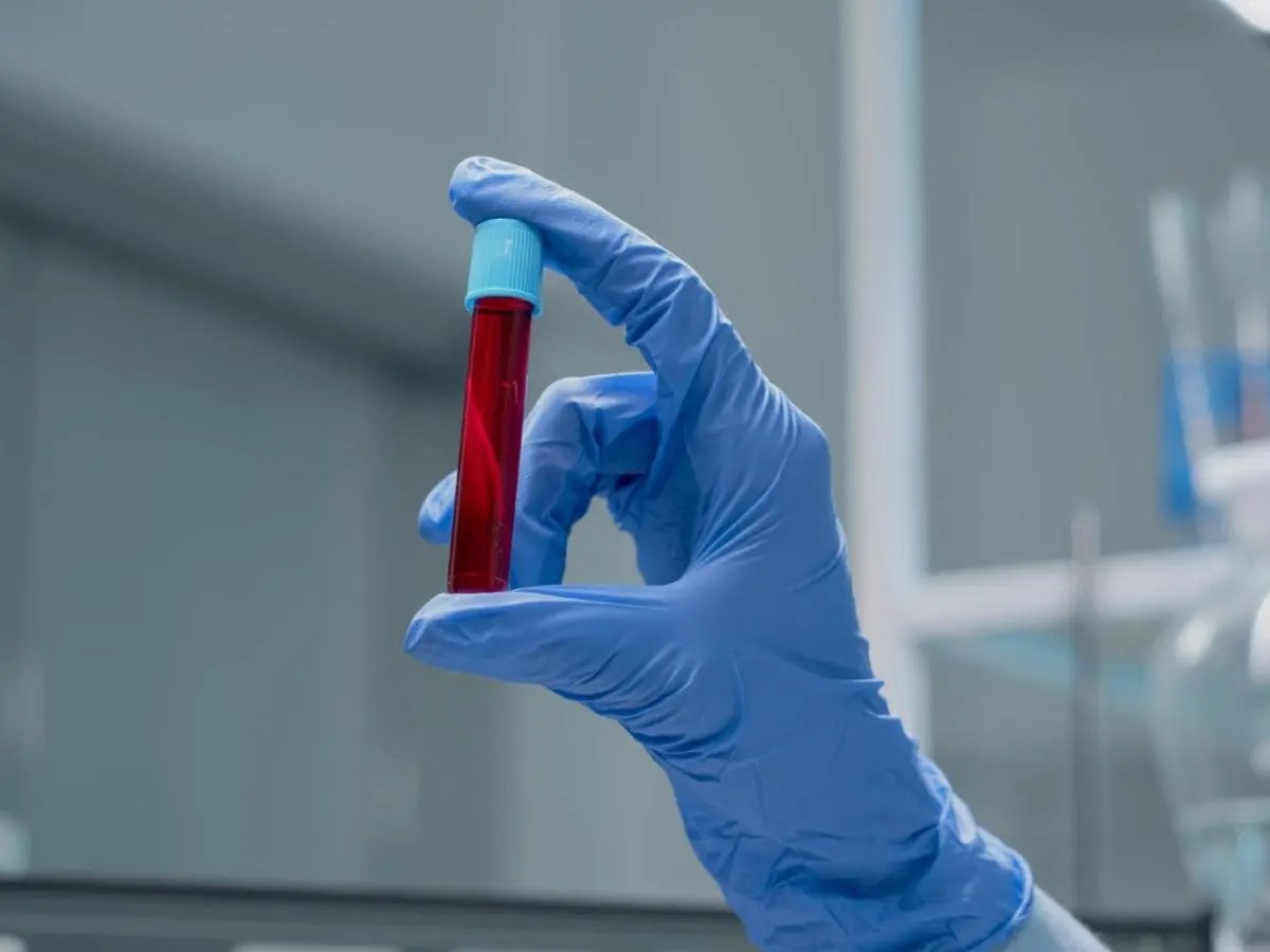 Free HIV Test Your Right to Know Your Status