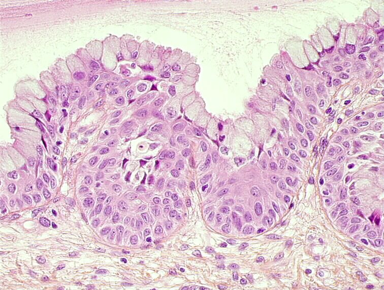 Histopathology of the uterine cervix digital atlas