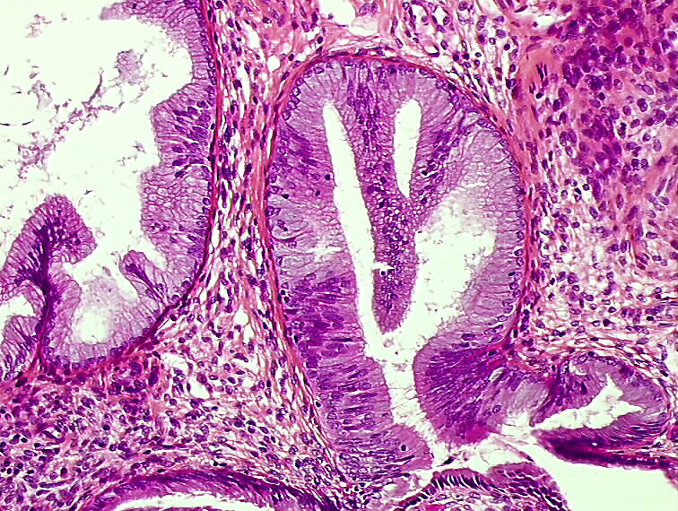 Histopathology of the uterine cervix digital atlas