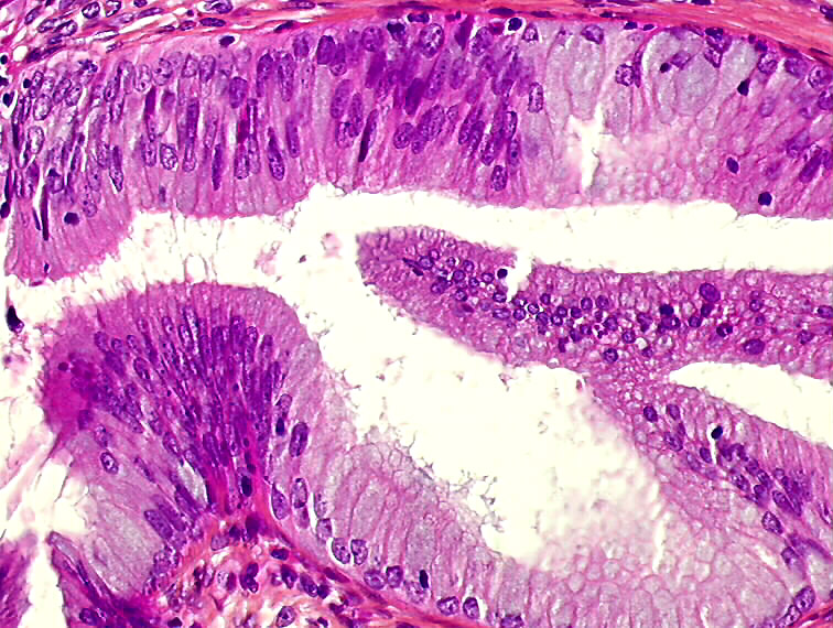 Histopathology of the uterine cervix digital atlas