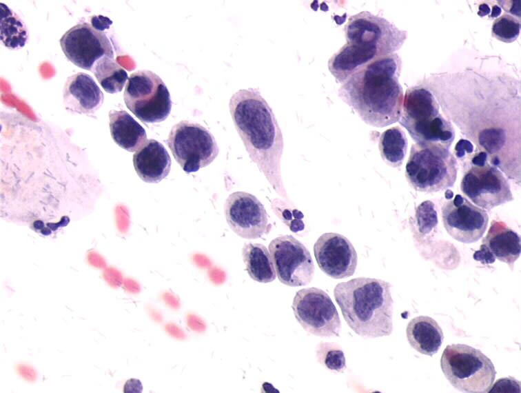 Cytopathology of the uterine cervix digital atlas