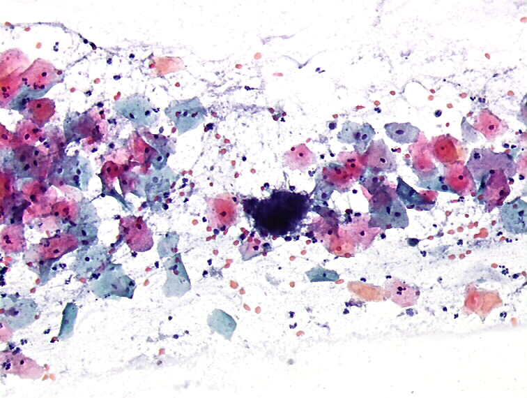 Cytopathology of the uterine cervix digital atlas