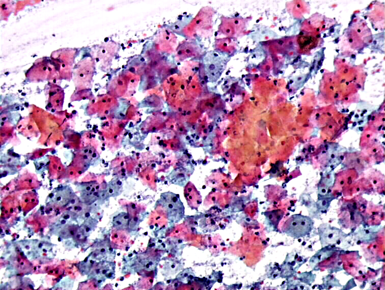 Cytopathology of the uterine cervix digital atlas