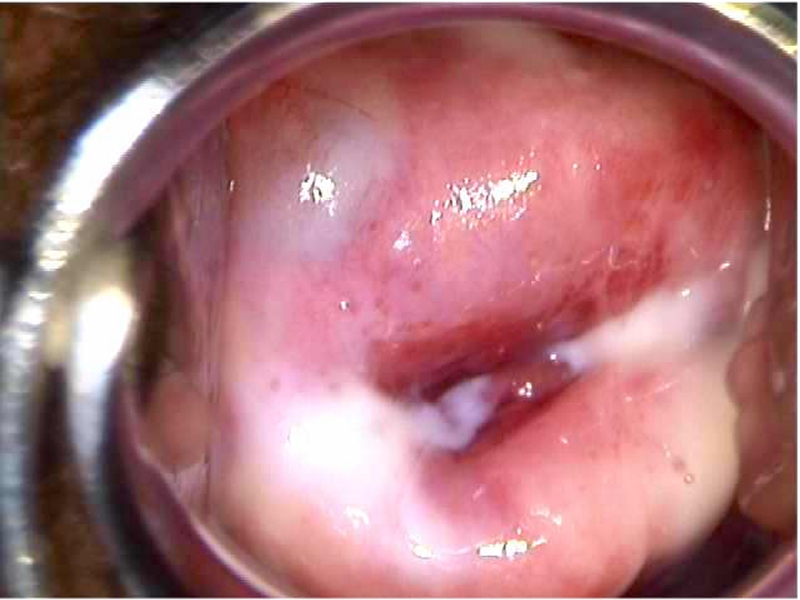 Colposcopy Digital Atlas