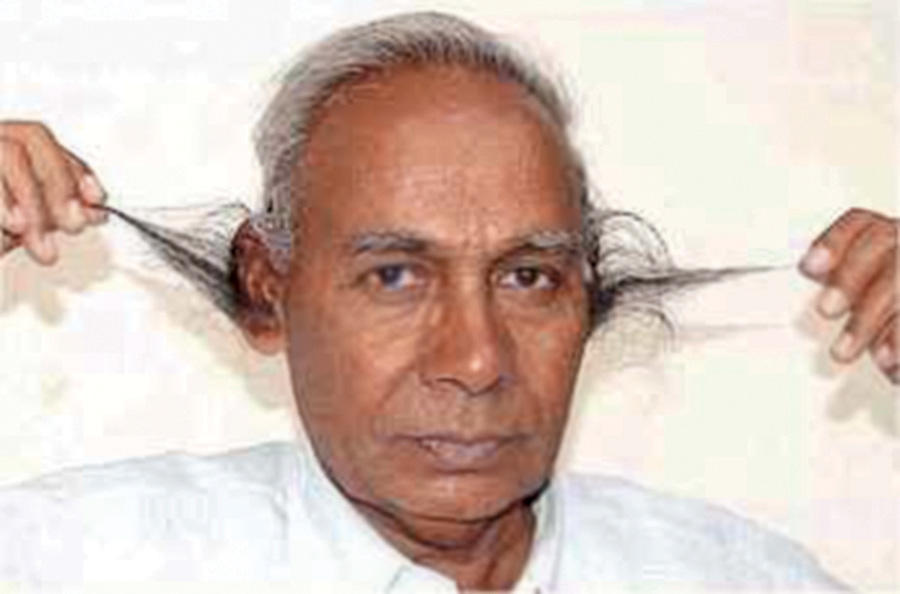 20 People Who Hold the Record for Largest Human Body Parts