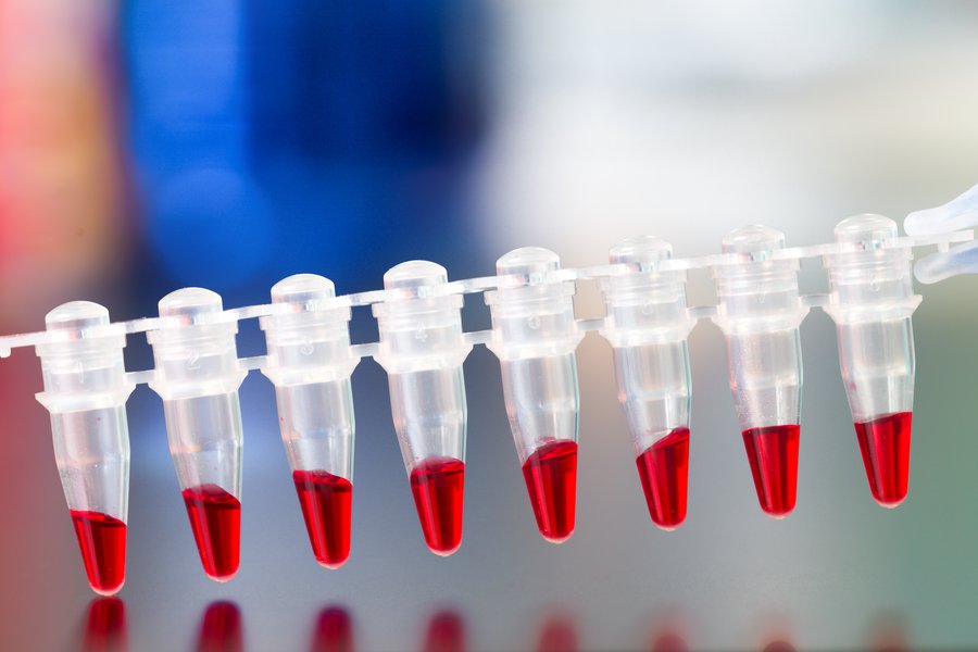 Una ejemplo Spanish to English Translation