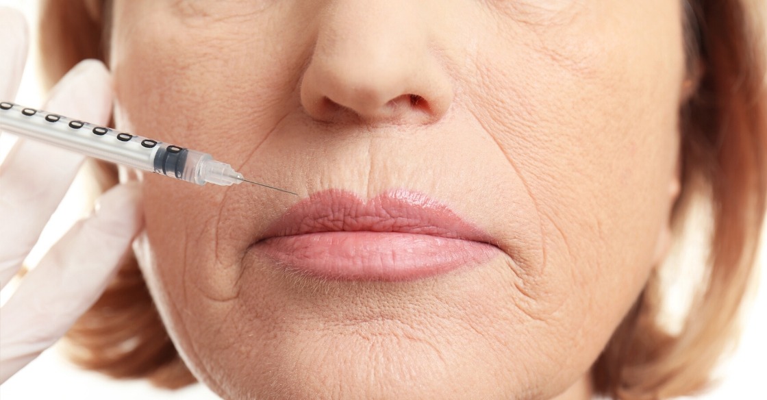 The Ultimate Guide to Botox San Diego Botox