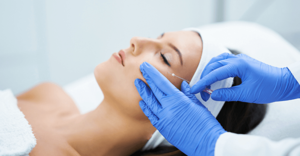 The New Face Lift PDO Thread Lift San Diego SD Botox