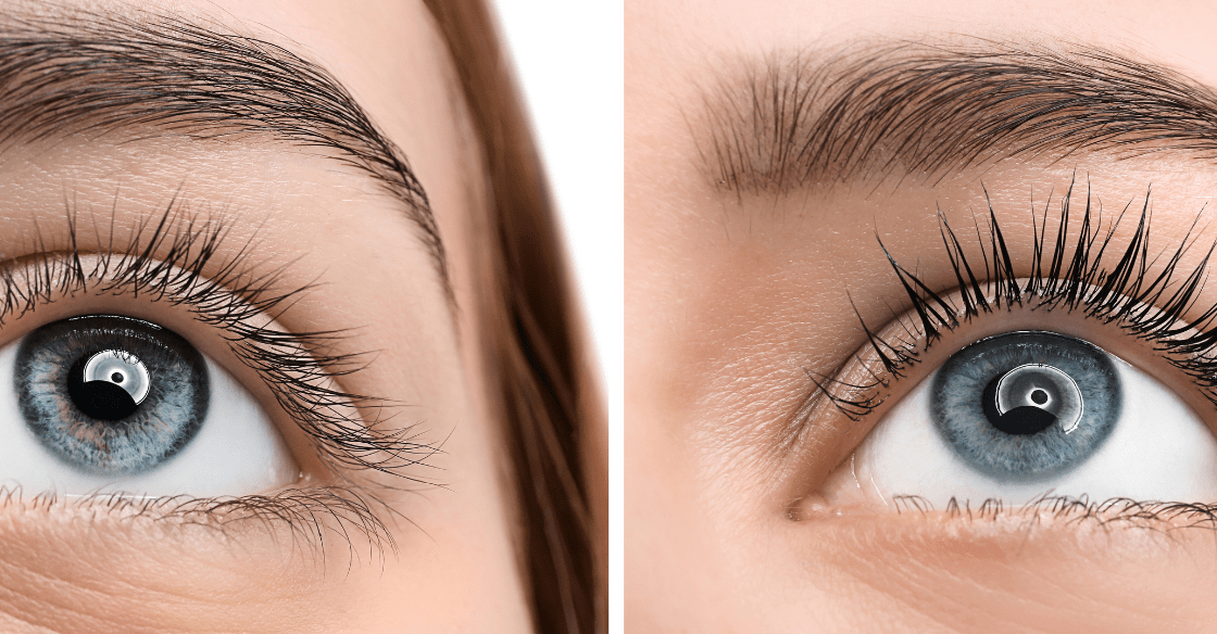 How to Grow Eyelashes That Are Fuller and Longer San Diego Botox