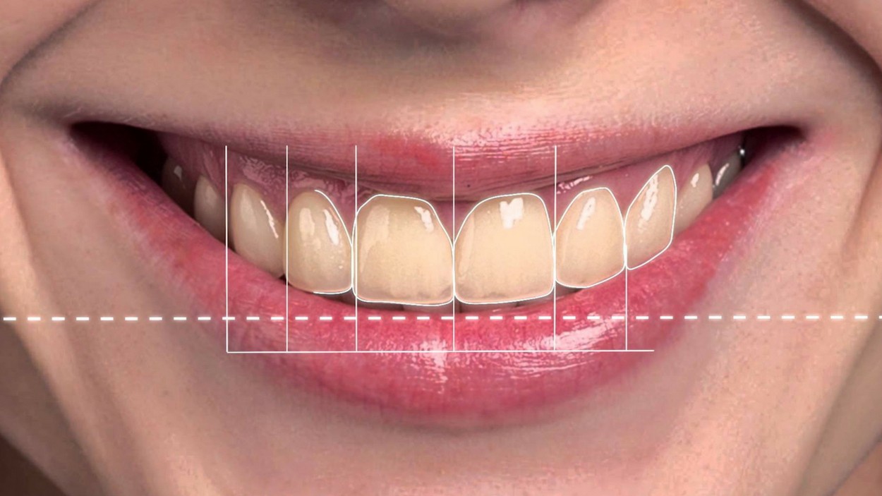 Healthy Smiles Dental Group Review Ratings & Information