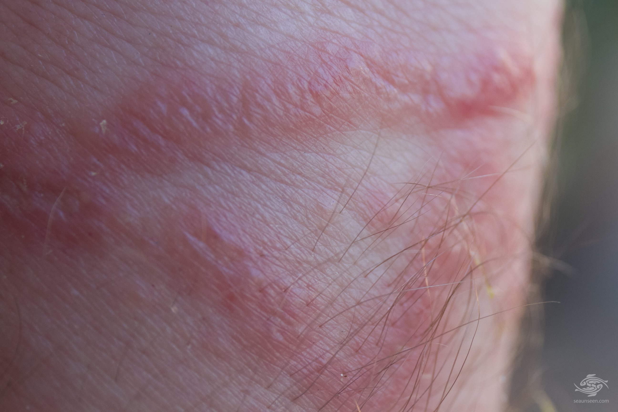 Sea Jellies or Jellyfish which is correct ? Seaunseen