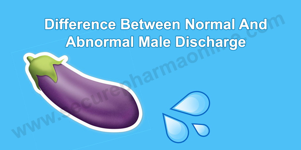 How To Know If Your Male Discharge Is Normal?