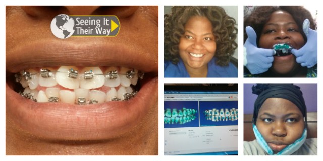 Adult Braces SureSmile