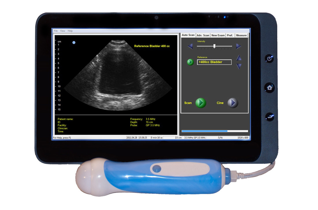 Portable Ultrasound Machines Canada VB10 Portable Ultrasound