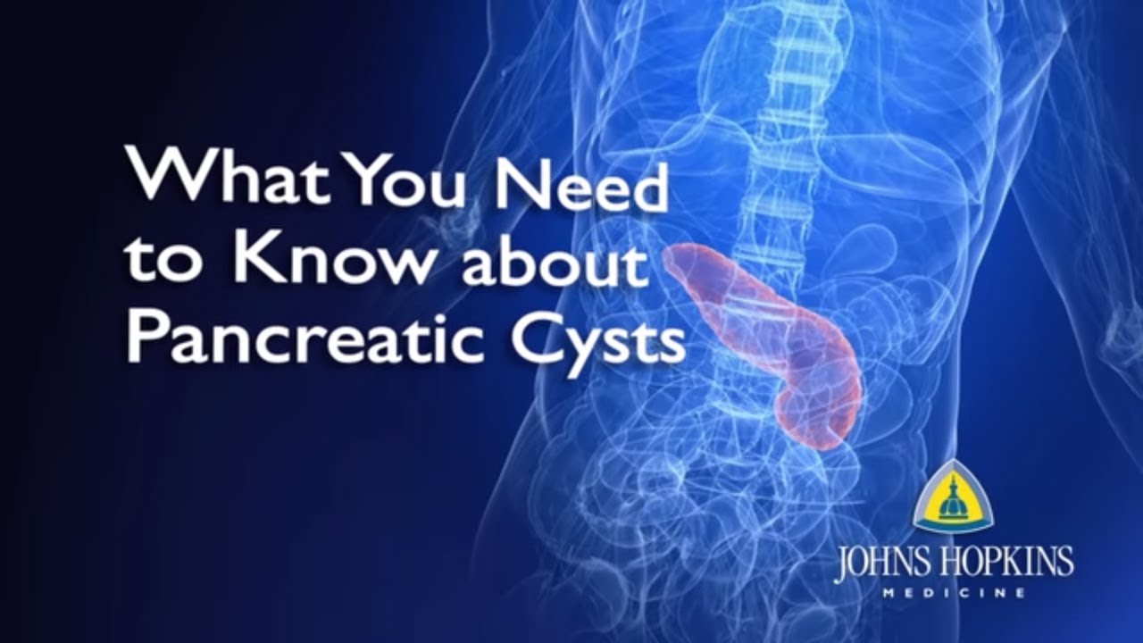 Pancreatic Cysts Can Be Benign, Precancerous or Malignant (Cancerous