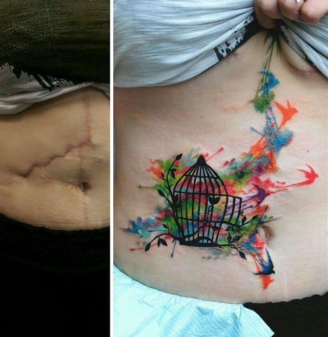 Tatuagem Para Tampar Cicatriz De Abdominoplastia Tatuagens para cobrir cicatrizes 21 ideias para recuperar a autoestima