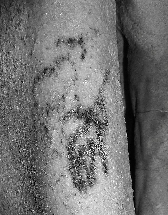 piores tatuagens do mundo (7) Amo Tatuagem Tatuagem feminina mais antiga do mundo tem 5 mil anos Segredos do Mundo