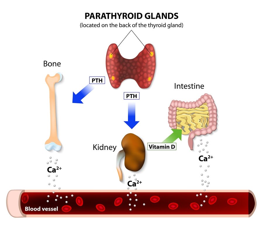 Hyperparathyroidism Symptoms, Treatments, & Prevention SelfHacked