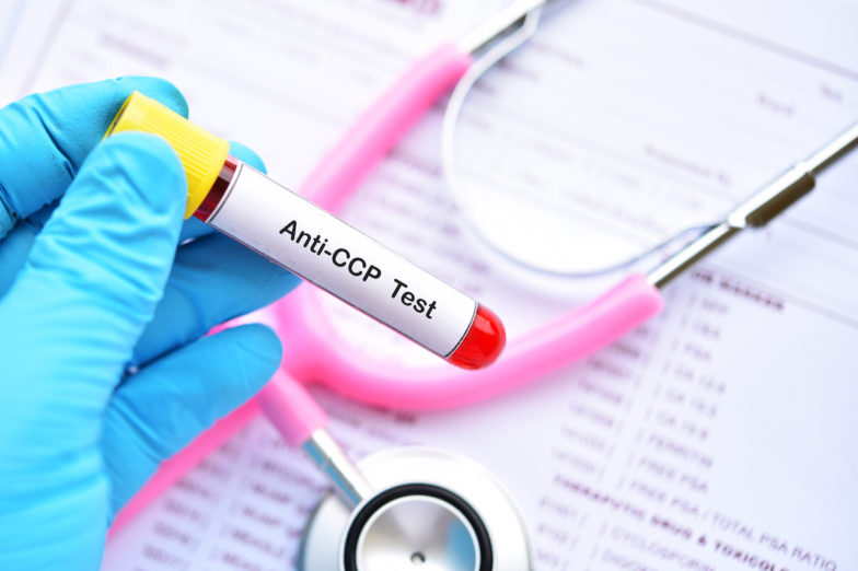 AntiCCP Antibody Test Results and What They Mean SelfHacked
