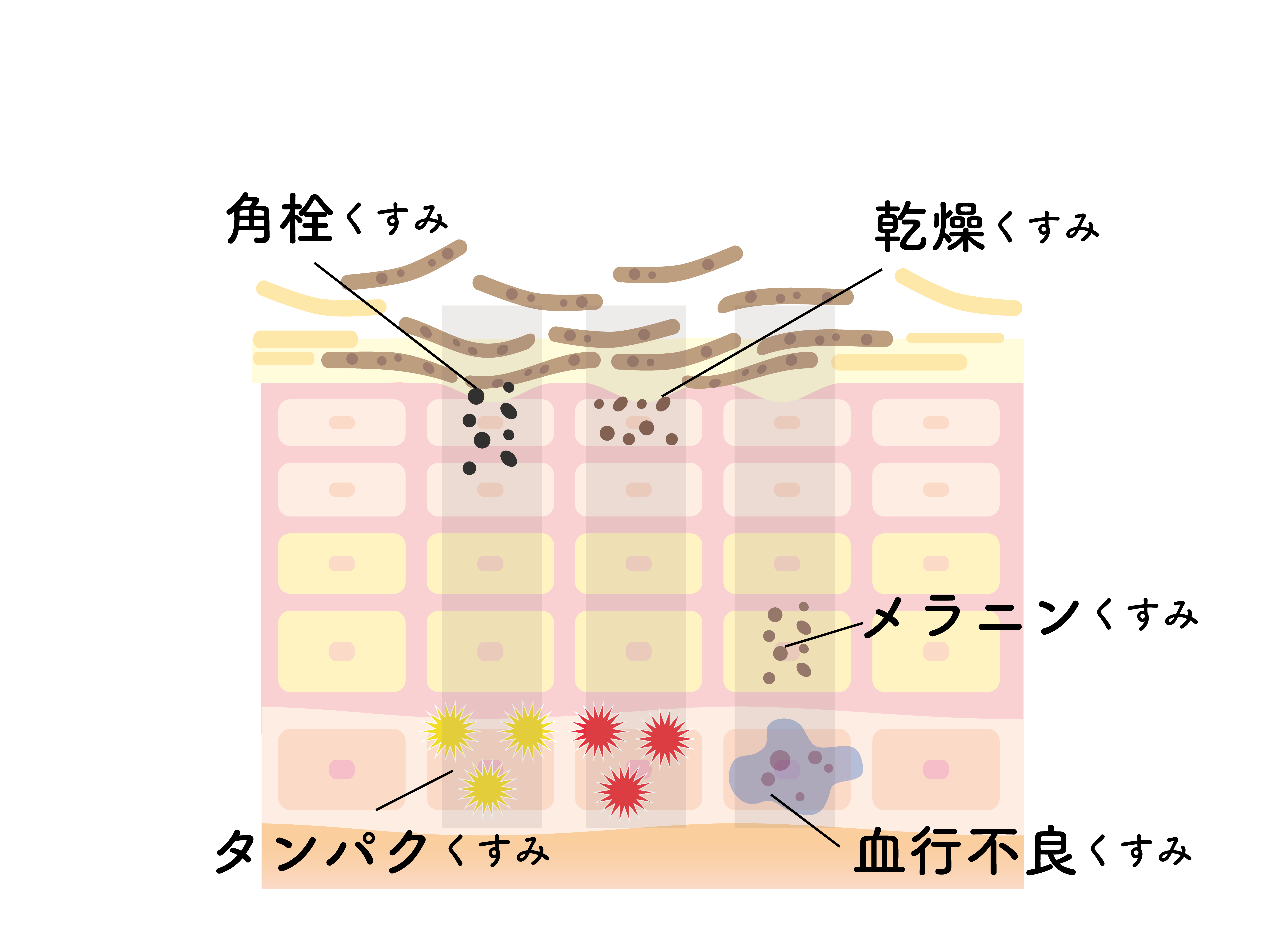あなたはどのタイプ？お肌のくすみの種類と原因
