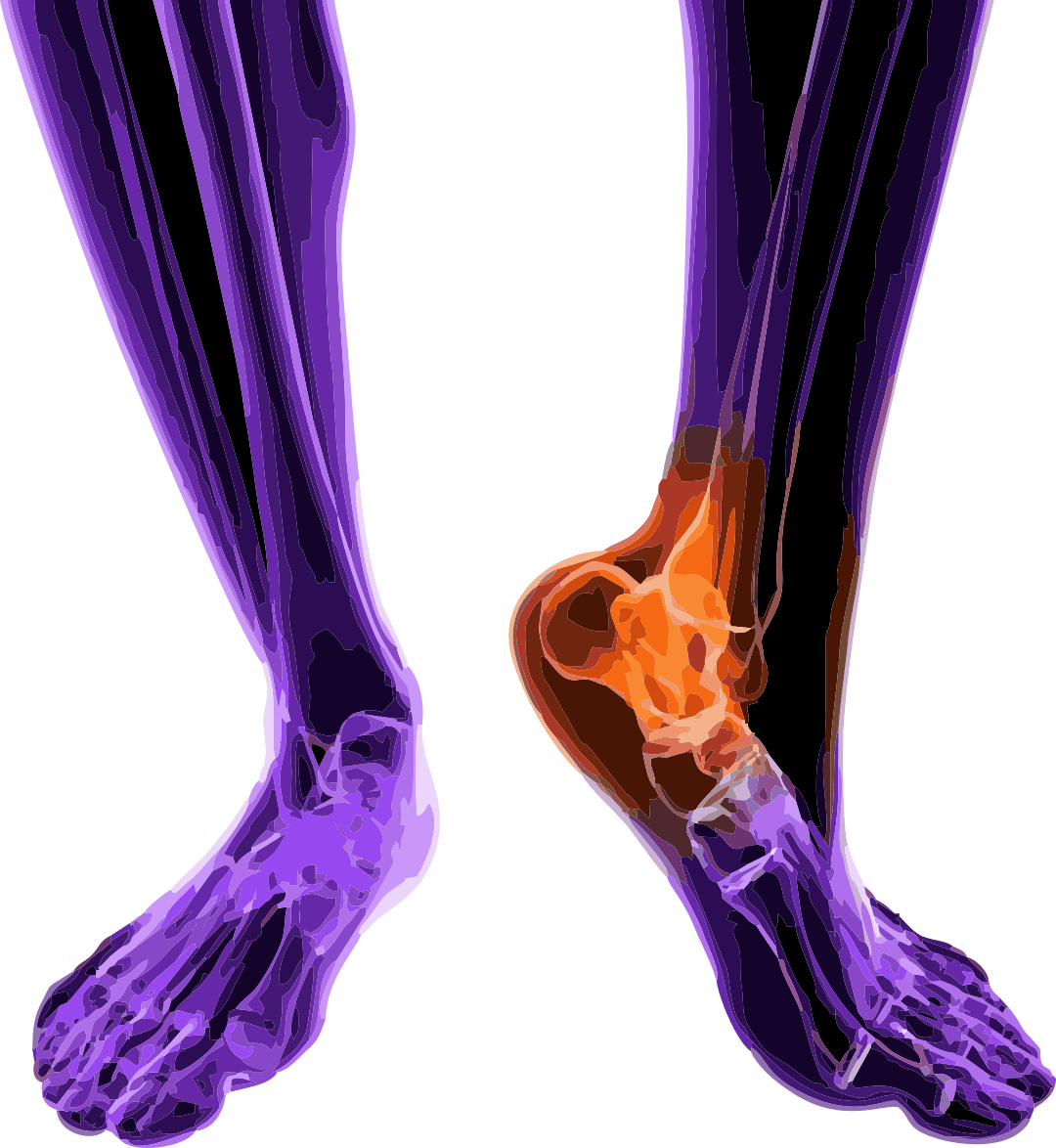 Orthopedic Sports Injuries Semih Ayanoglu MD Treatments & Practices