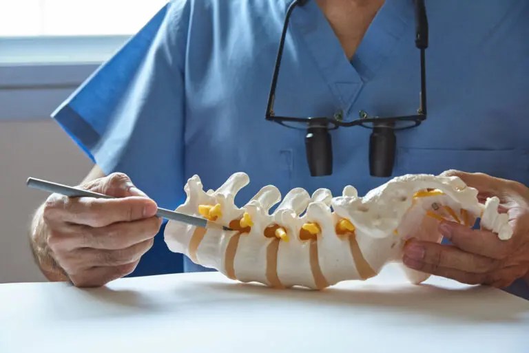 Spine Treatment an Alternative to Spinal Fusion 2024 Guide Health