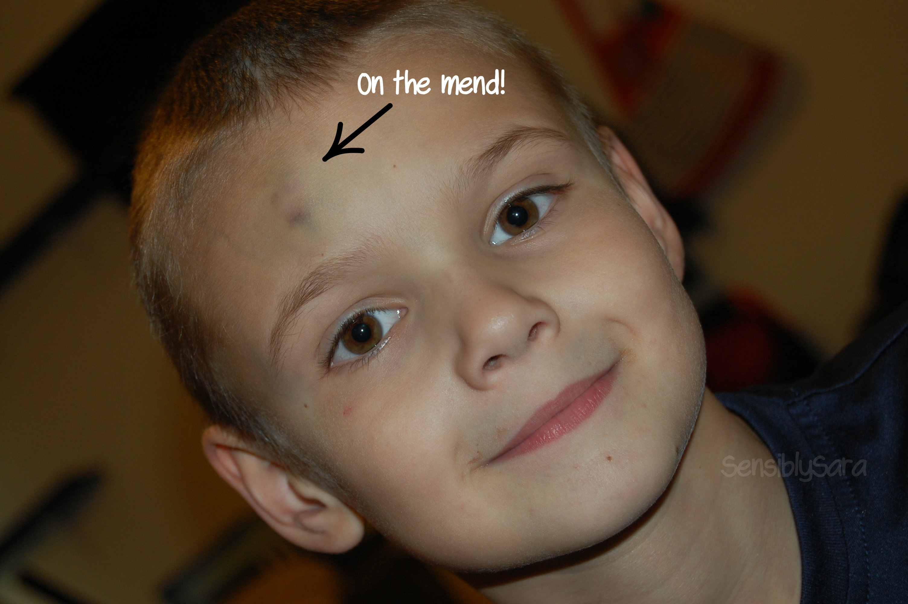 Goose egg on head healing time