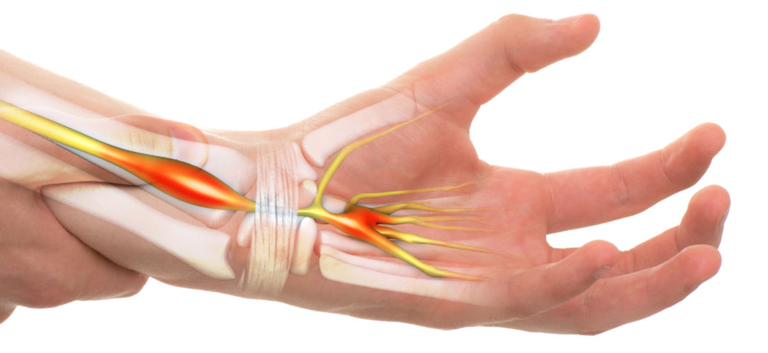 handsurgery Sentinel Plastic Surgery