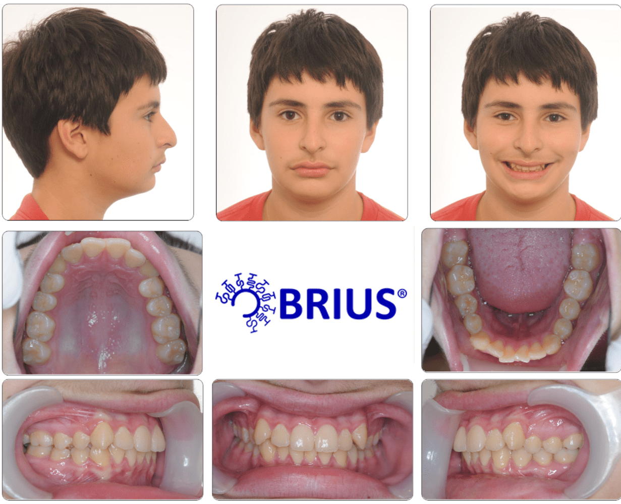 Brius Orthodontics Clinton, Charles County & St. Mary’s County MD