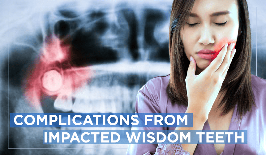Serious Complications From Impacted Wisdom Teeth » Top Cosmetic Dentist