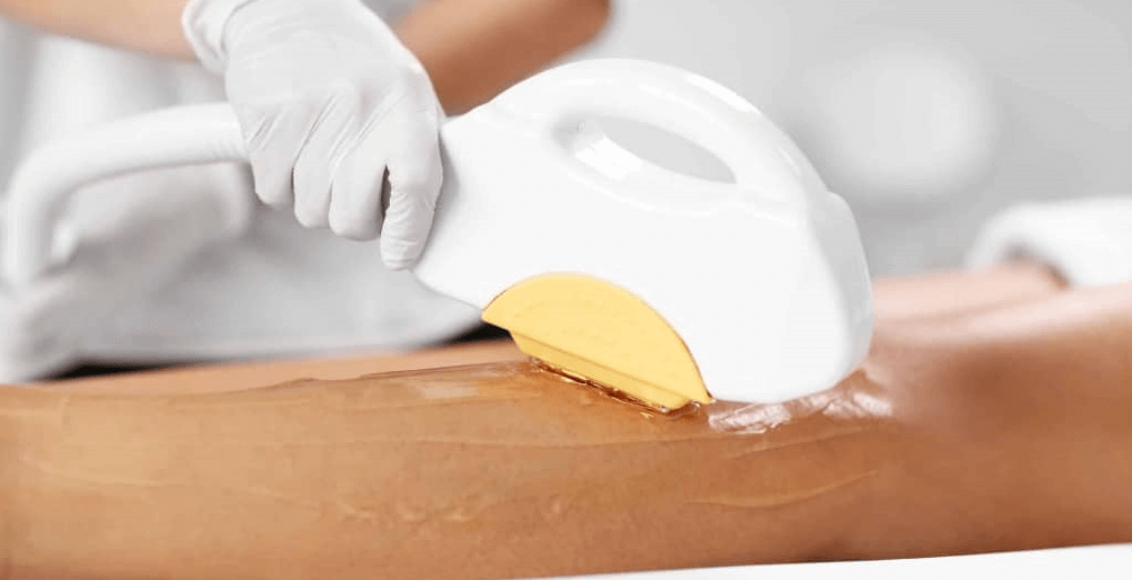 IPL Hair Removal Perth Serene Day Spa