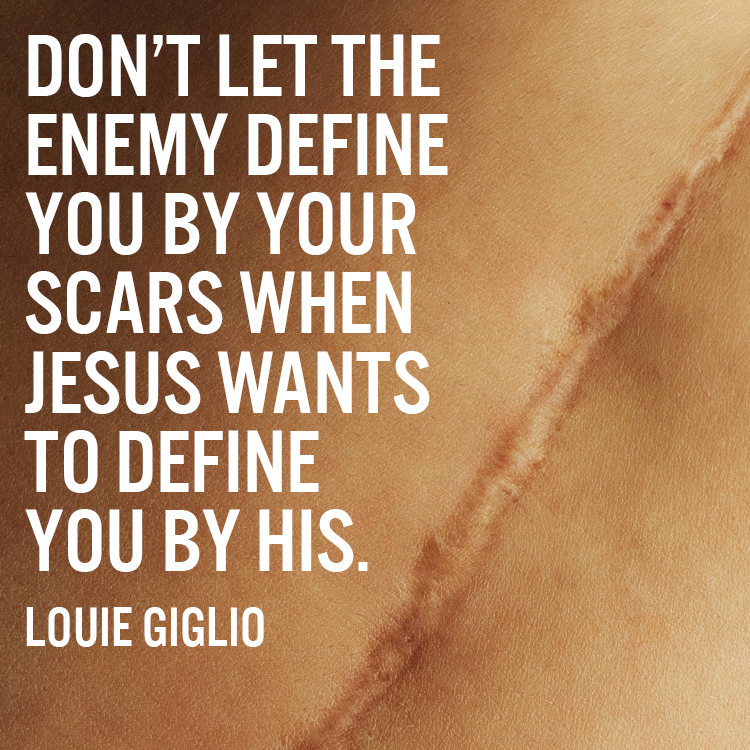 Don't let the enemy define you by your scars when Jesus wants to define