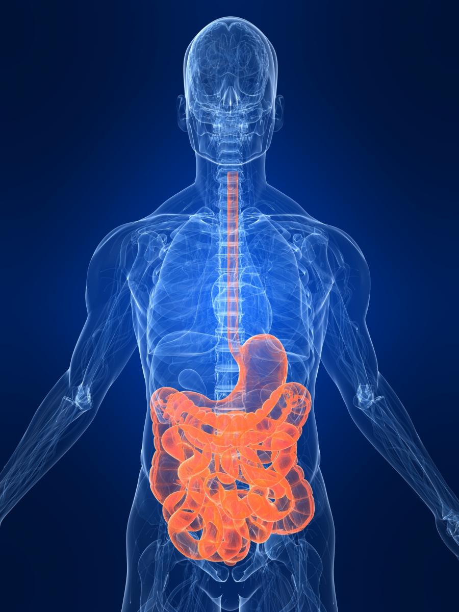 TRATAMIENTO DE LA ENFERMEDAD INFLAMATORIA INTESTINAL ( Colitis