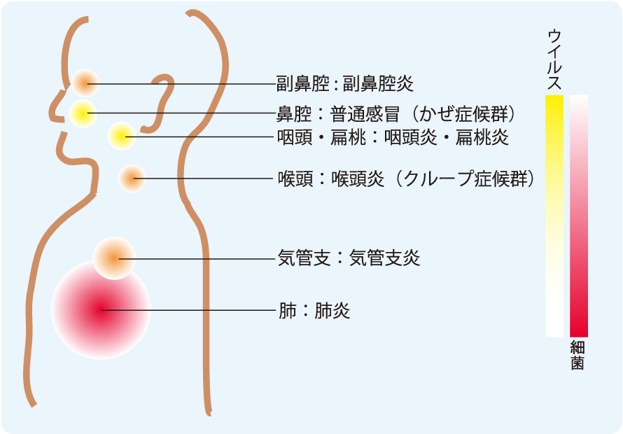 小児の長引く咳について 【小林耳鼻咽喉科医院】 世田谷の耳鼻咽喉科 めまい 耳鳴り アレルギー性鼻炎 耳鼻科