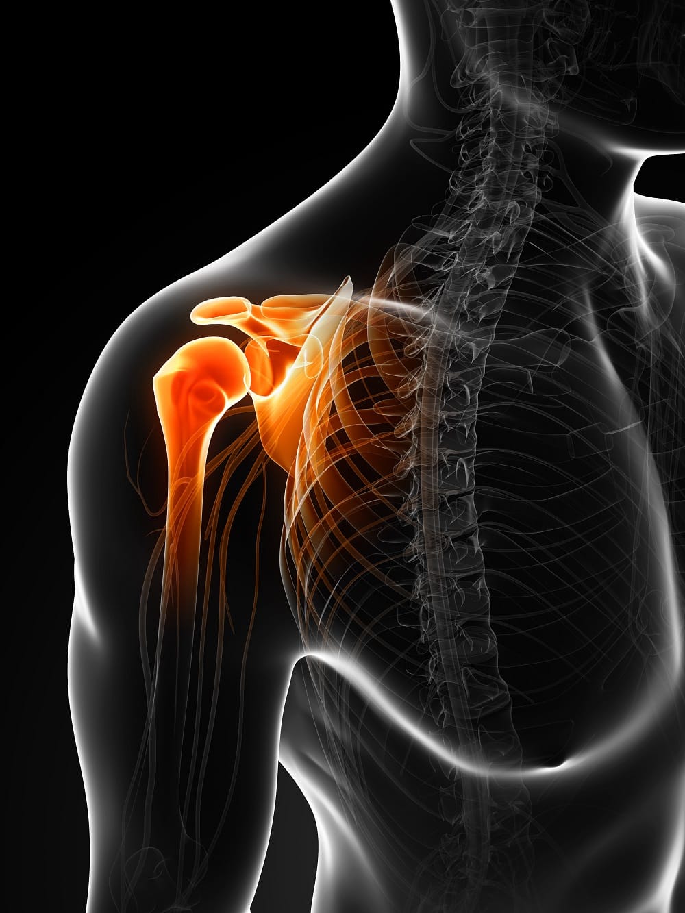 Rotator Cuff Syndrome and Impingement Shoulder Series, Pt 2
