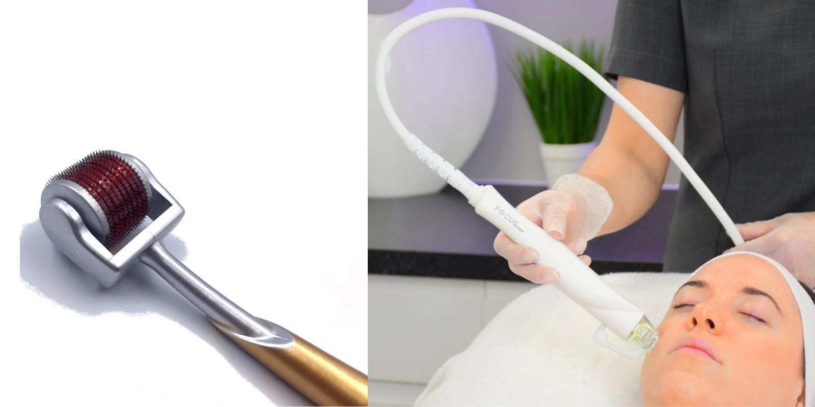 Derma roller vs RF Microneedling Setsuko Beauty Clinic