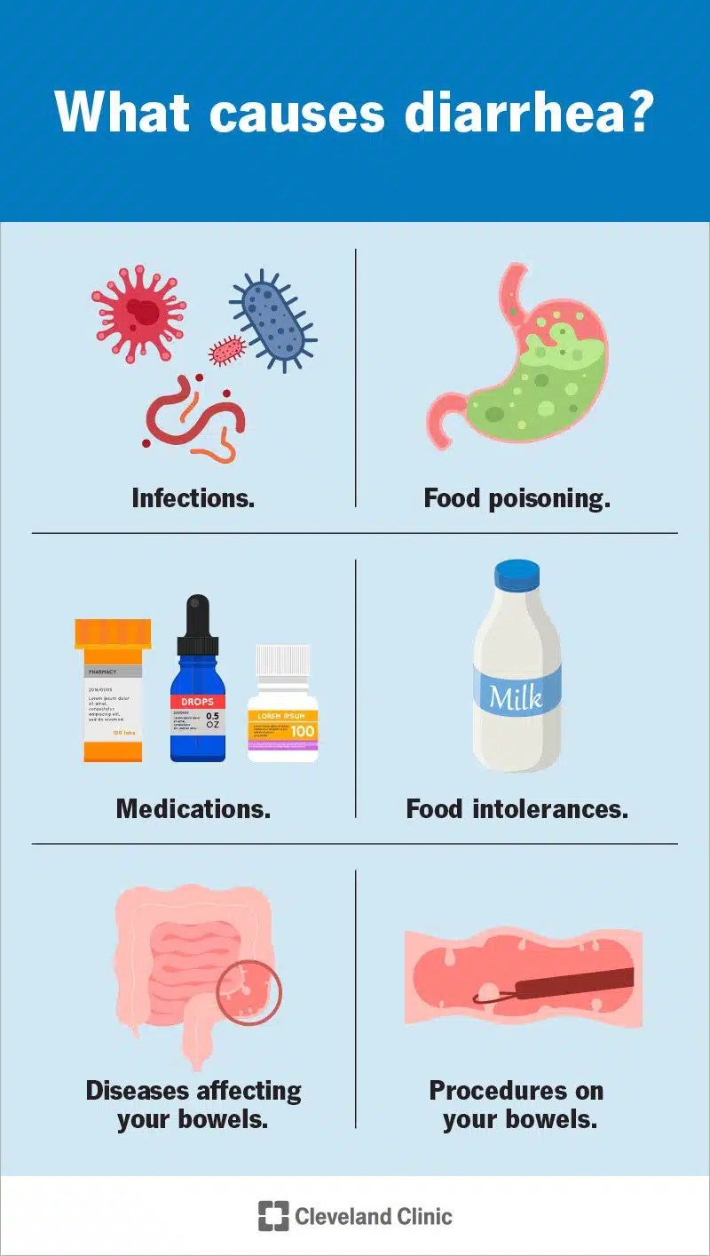 Kõhulahtisus Põhjused, Sümptomid Ja Ravi SFOMC