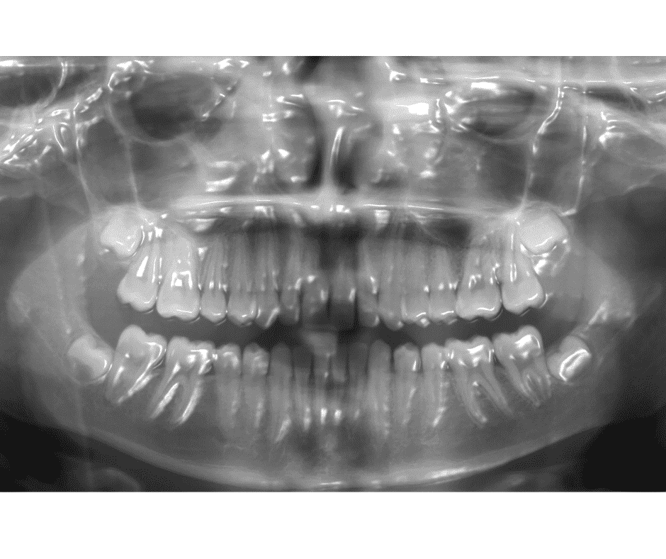 Dental Technology & Amenities • Five Star Rated Cumming Dentist