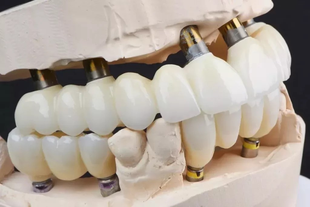 Allonfour by Sharp Dentistry & Associates