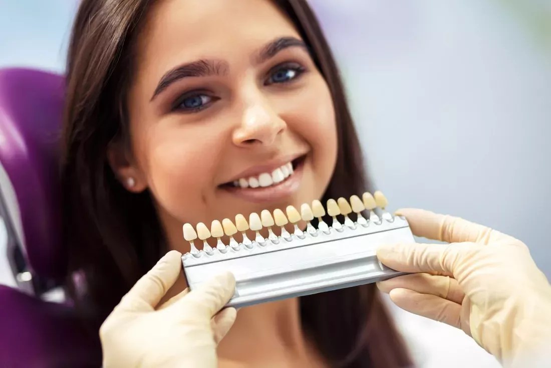 Brighten Your Smile With Veneers Sharp Dentistry & Associates
