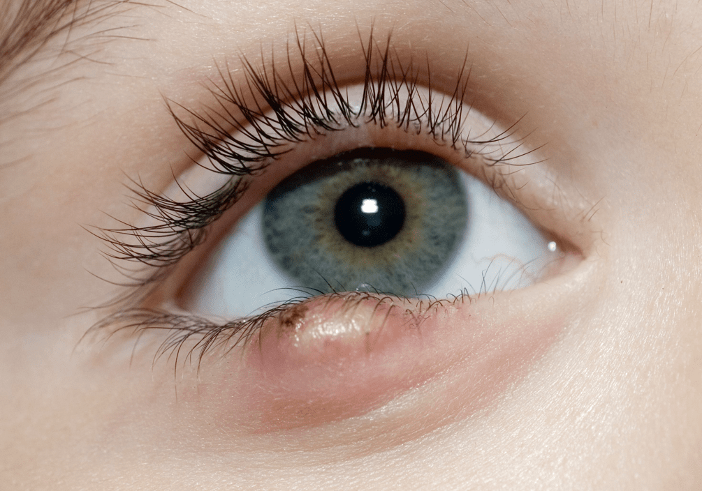 Can Dogs Get Styes From Humans